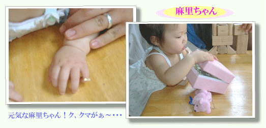 ����������1�Βa�����v���[���g�̃x�r�[�����O�ɑ���